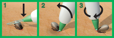 Trix 81211     Tickremover (,  1)